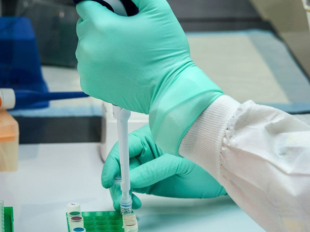Technician preparing labeled sample vials for acid additive formulation testing